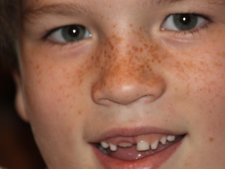 lnt10.7
